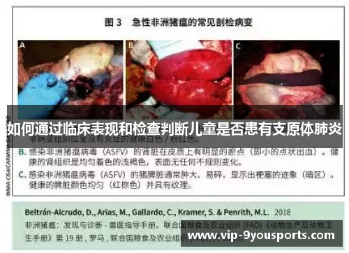 如何通过临床表现和检查判断儿童是否患有支原体肺炎